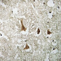 SMAD3 (Phospho-S204) Antibody抗