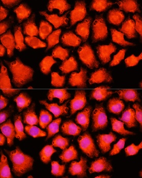 ACO2 Antibody抗体,orb1257842,bio
