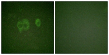 IGF-IR (phospho Tyr1161) rabbi