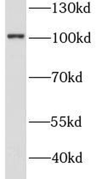STT3A Antibody抗体，orb631616，bio