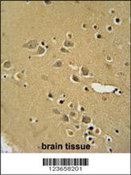 AMY2B Antibody抗体，orb1270657，bi