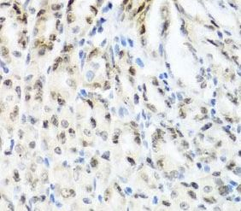 YTHDF3 Antibody抗体，orb632667，bi