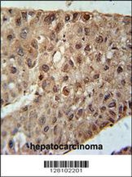 ZC4H2 Antibody抗体，orb1270608，bi