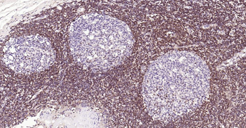 Bcl-2 Recombinant Rabbit Monoc