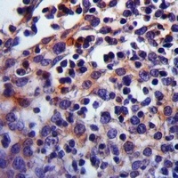 Carbonic Anhydrase 1 Antibody抗