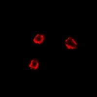 TRHR Antibody抗体，orb665825，bior