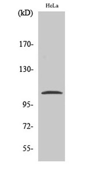 NFκB-p105 (phospho Ser932) rab