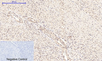 NFκB-p65 (phospho Ser276) rabb
