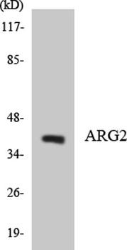 Arginase II rabbit pAb抗体,orb76
