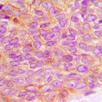 JAK2 (Phospho-Y1007) Antibody抗