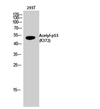 p53 (Acetyl Lys372) rabbit pAb