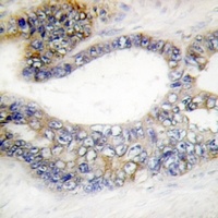 DCR3 Antibody抗体，orb665733，bior