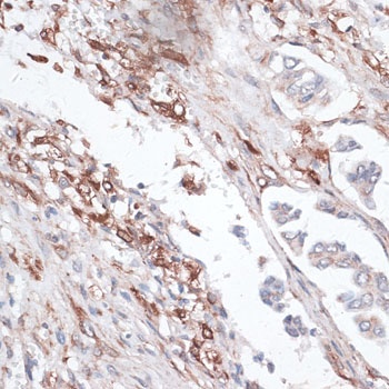 Vimentin Antibody抗体,orb1258103