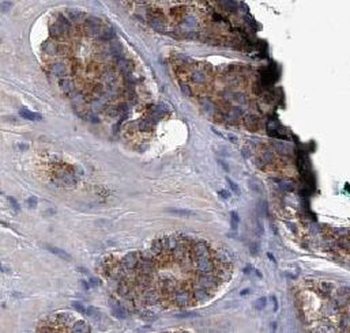 HRAS Antibody抗体，orb756623，bior