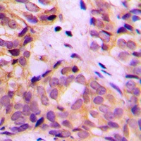 ALDH1A2 Antibody抗体，orb235005，b