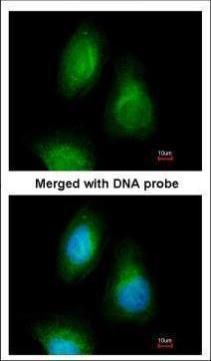 SEPHS2 antibody [N3C3]抗体，orb55