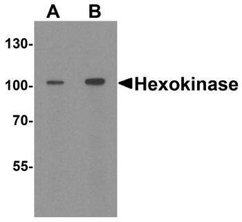 Hexokinase 1 Antibody抗体，orb123