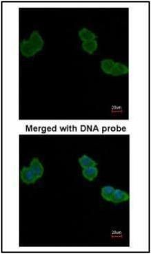 Aminoacylase 1 antibody [N2C3-