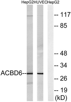 ACBD6 rabbit pAb抗体,orb764453,b
