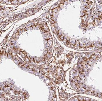 TEX38 Antibody抗体,orb631826,bio