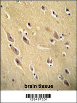 CYB561D1 Antibody抗体，orb1270421