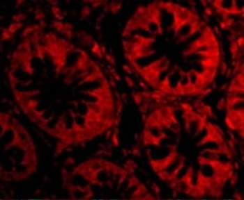 TEM1 Antibody抗体，orb1240088，bio