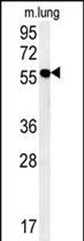 ZMYND10 Antibody (C-term)抗体，or