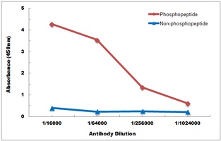 FOXO1 (Phospho-S256) Antibody抗