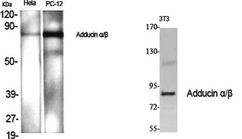 Adducin α/β rabbit pAb抗体，orb76