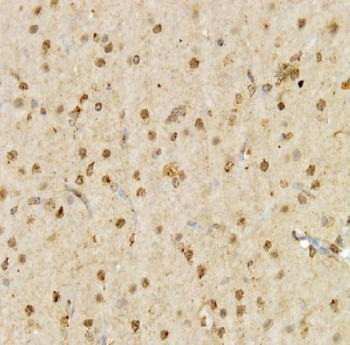 SIM2 Antibody抗体，orb631190，bior