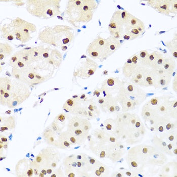 RAB3IP Antibody抗体，orb1256000，b