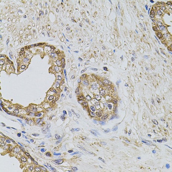 PLK4 Antibody抗体，orb1255543，bio