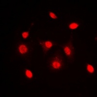 Dyskerin Antibody抗体,orb318768,