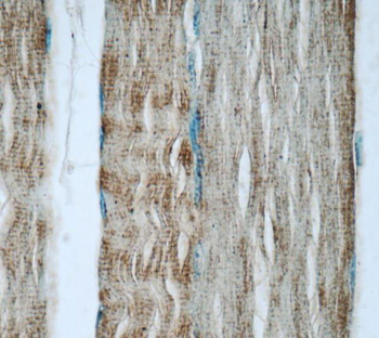 TNNT3 Antibody抗体，orb632031，bio