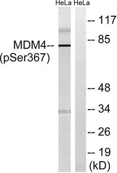 MDMX (phospho Ser367) rabbit p