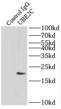UBE2C Antibody抗体，orb632299，bio