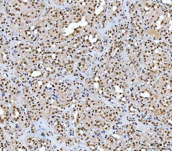 AREB6/ZEB1 Antibody (monoclona