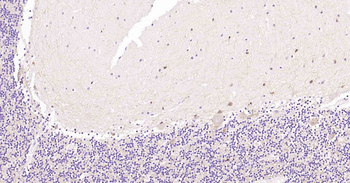 Tau-4 Mouse Monoclonal Antibod