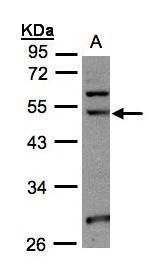 NSUN6 antibody [N3C3]抗体，orb556