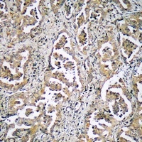 ADAMTS17 Antibody抗体，orb665873，