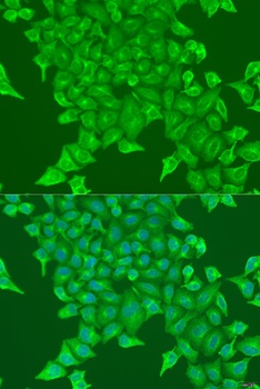 BST2 Antibody抗体，orb1258394，bio