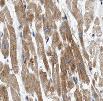 TYR Antibody抗体，orb632933，biorb