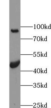 SLC39A8 Antibody抗体，orb632730，b