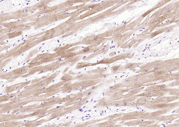 Cardiac Troponin I/TNIC Mouse 