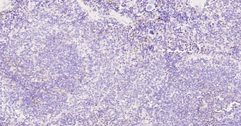 Tau-4 Mouse Monoclonal Antibod