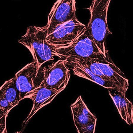 BMP4 Antibody抗体，orb333926，bior