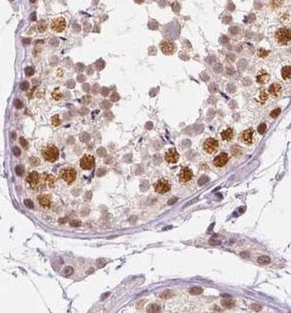 UBE2E2 Antibody抗体，orb632304，bi