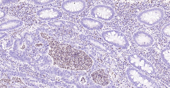 5 Lipoxygenase Recombinant Rab