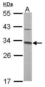 MTAP antibody [N1C3]抗体，orb5565
