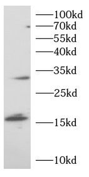 TREM1 Antibody抗体，orb1100484，bi